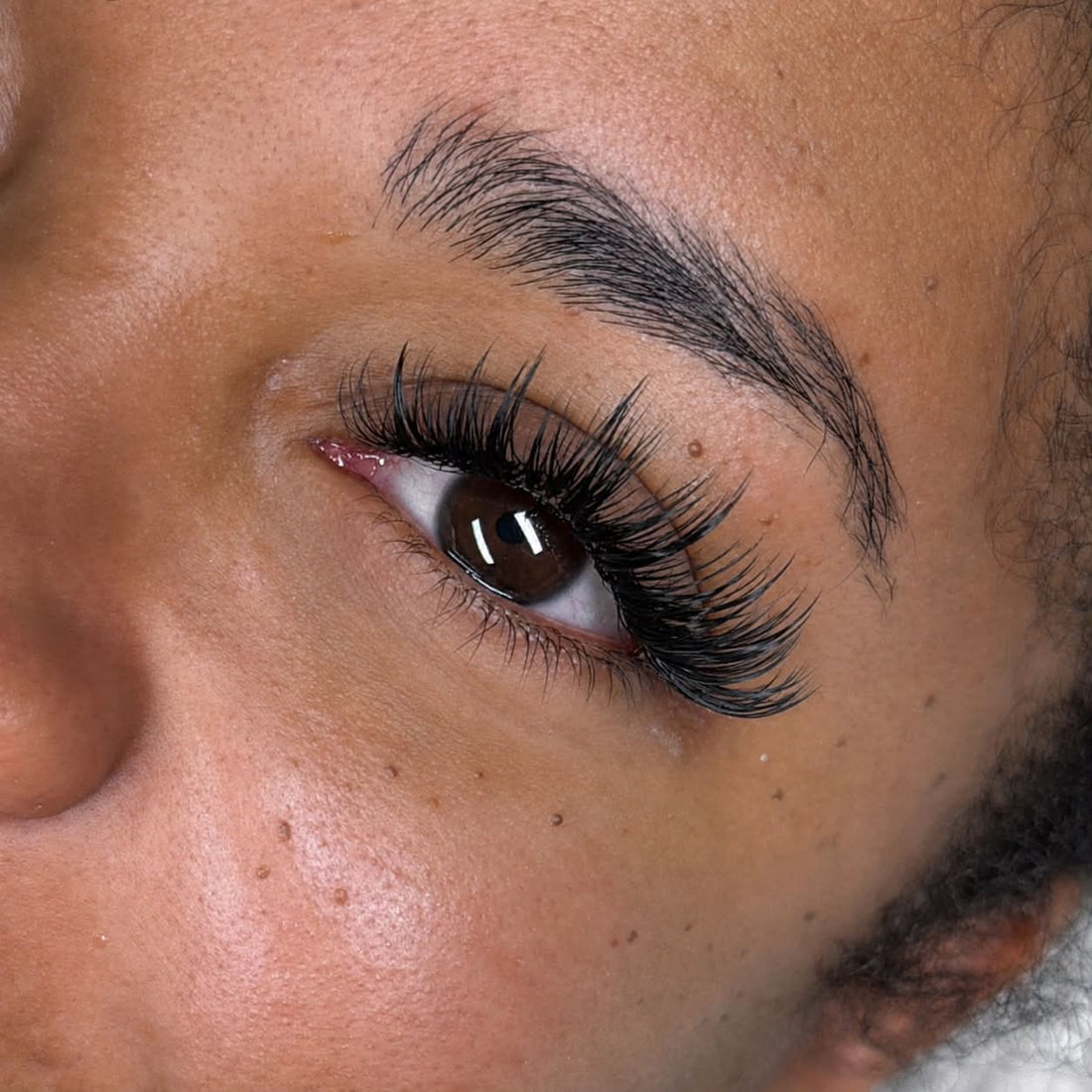 On the eyes